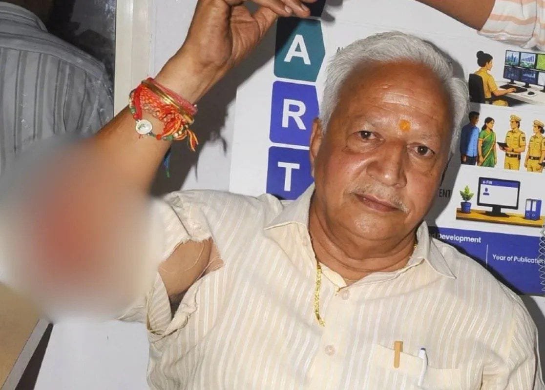पाली में कांग्रेस विधायक के भाई पर हमला: स्कूटी गिराकर मारपीट, फटे कपड़ों में थाने पहुंचे; सिंबल वाले लिफाफे को लेकर गरमाया विवाद